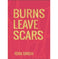 imag1Burns Leave Scars